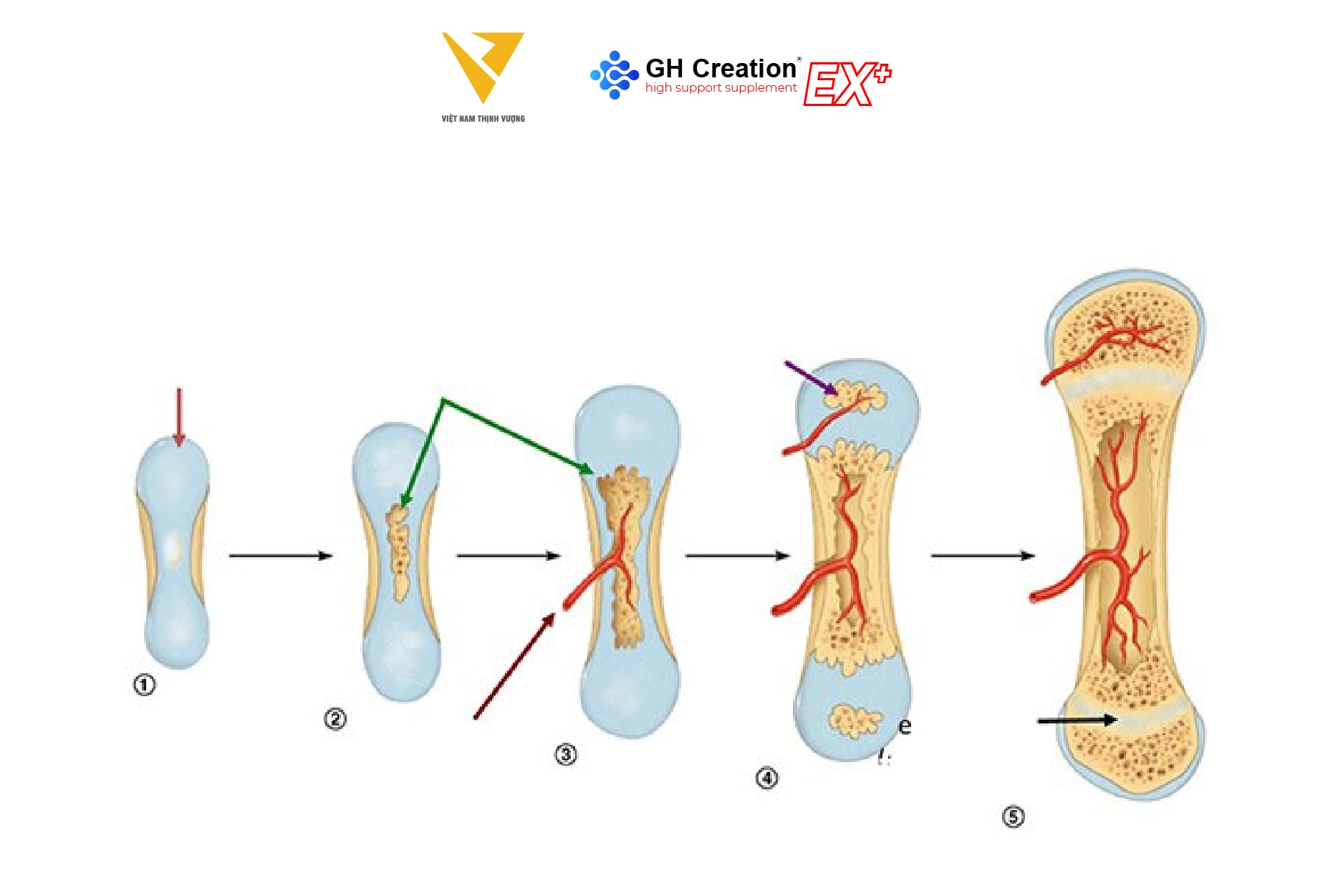 Quá trình cốt hóa xương