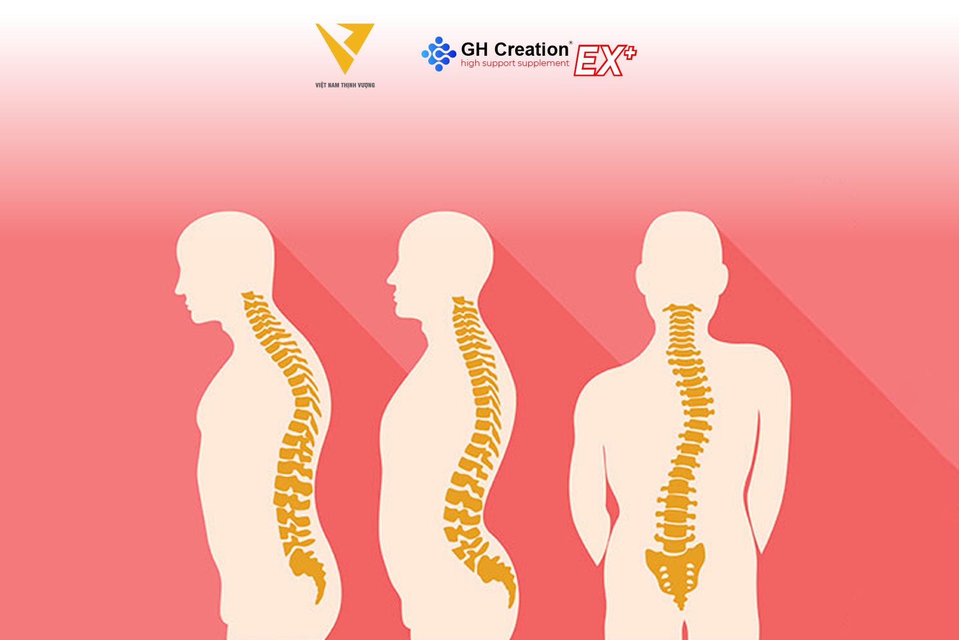 Cong vẹo cột sống cổ (Kyphosis)