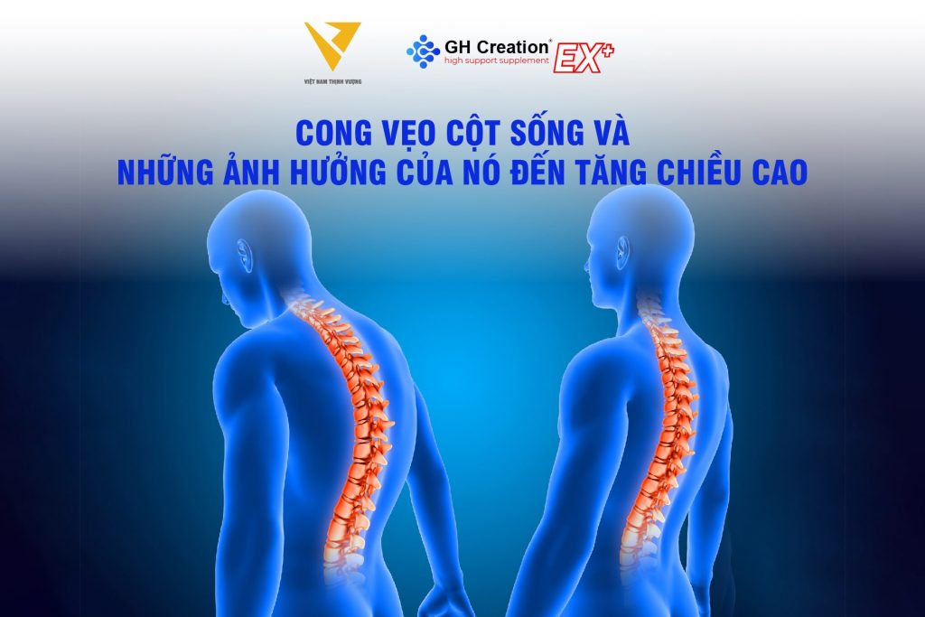 cong vẹo cột sống ảnh hưởng đến tăng chiều cao