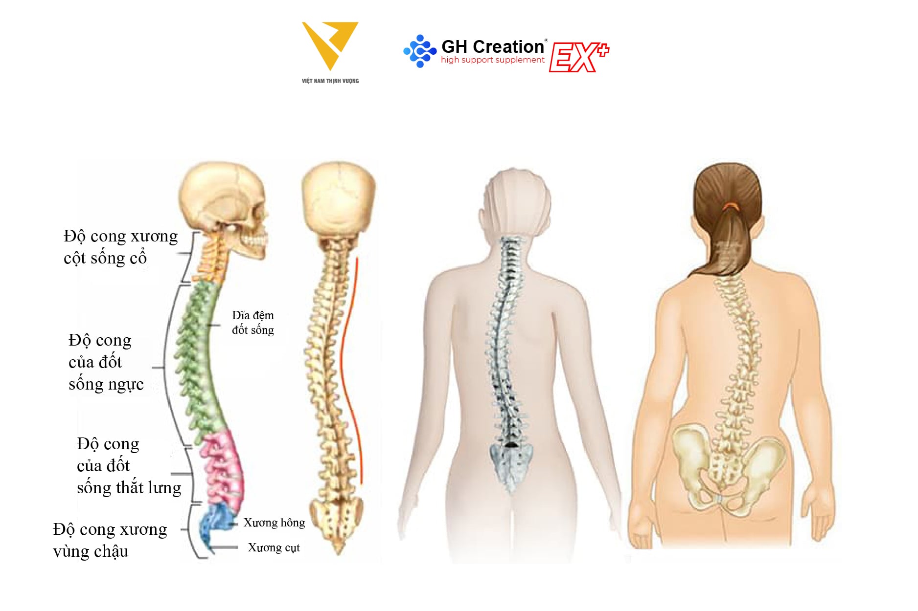 Những nguyên nhân và tác động dẫn đến tình trạng cong vẹo cột sống